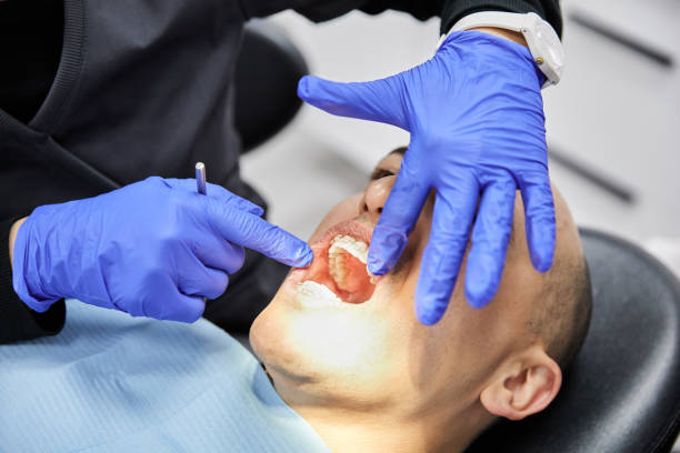 Best Knocked-Out Tooth (Avulsed Tooth) Treatment in Brookings, SD